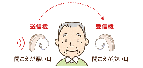 CROSの基本的な仕組み。1.送信機のマイクが聞こえが悪い側の音を集め、聞こえが良い側の耳へワイヤレスで伝送します。2.より良い耳側に装用した補聴器が受信機として音を受け取り外耳道へと送ります。